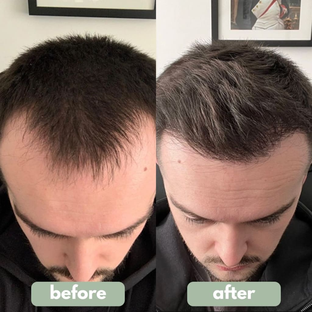 Rosemary Hair Growth Roller Essence